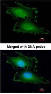 Immunocytochemistry/ Immunofluorescence: Peflin Antibody [NBP1-31613]