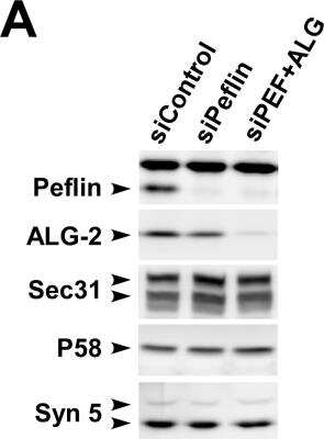 Knockdown Validated: Peflin Antibody [NBP1-31613]