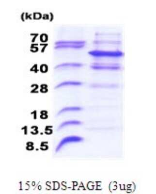 SDS-PAGE: Recombinant Human Pellino 2 His Protein [NBP2-51804]