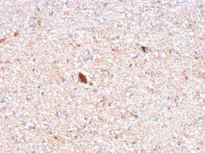 Immunohistochemistry-Paraffin: Pentraxin 2/SAP Antibody (APCS/3240) - Azide and BSA Free [NBP2-79848]
