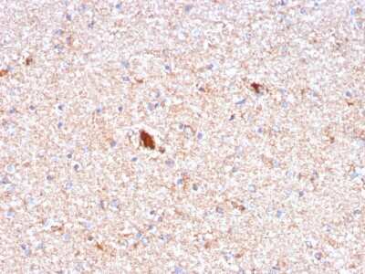 Immunohistochemistry-Paraffin: Pentraxin 2/SAP Antibody (APCS/3240) [NBP2-79714]