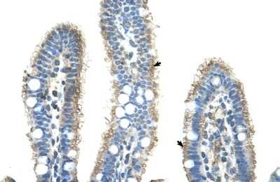 Immunohistochemistry-Paraffin: Pentraxin 2/SAP Antibody [NBP1-58970]