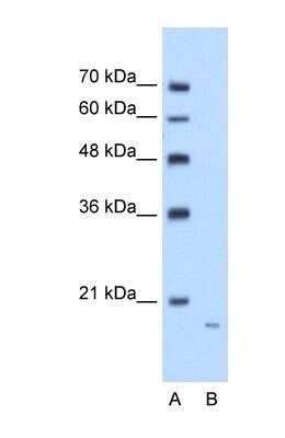 Western Blot: Pentraxin 2/SAP Antibody [NBP1-58970]