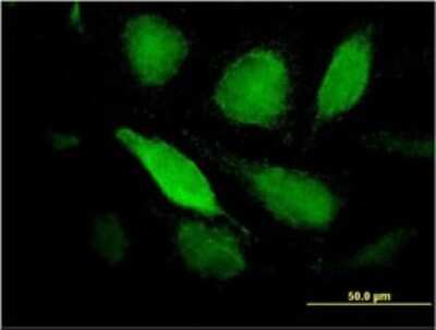 Immunocytochemistry/ Immunofluorescence: Pentraxin 3/TSG-14 Antibody (2B10) [H00005806-M02]