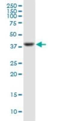 Western Blot: Pentraxin 3/TSG-14 Antibody (2B10) [H00005806-M02]