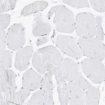 Immunohistochemistry-Paraffin: Pepsinogen C/PGC/Progastricsin Antibody [NBP1-91011]