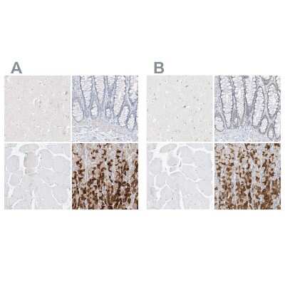 Immunohistochemistry-Paraffin: Pepsinogen C/PGC/Progastricsin Antibody [NBP1-91012]