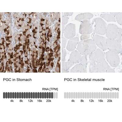 Immunohistochemistry-Paraffin: Pepsinogen C/PGC/Progastricsin Antibody [NBP1-91012]