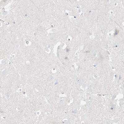 Immunohistochemistry-Paraffin: Pepsinogen C/PGC/Progastricsin Antibody [NBP1-91012]