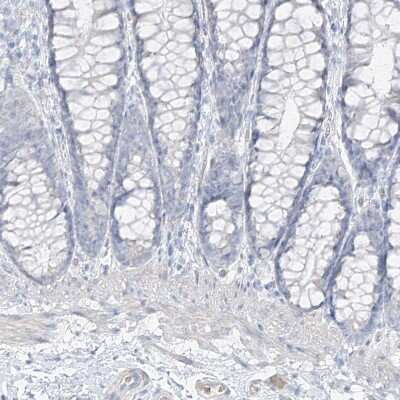 Immunohistochemistry-Paraffin: Pepsinogen C/PGC/Progastricsin Antibody [NBP1-91012]