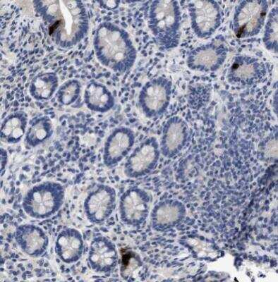 Immunohistochemistry-Paraffin: Peptide YY Antibody (1) - BSA Free [NBP1-05167]