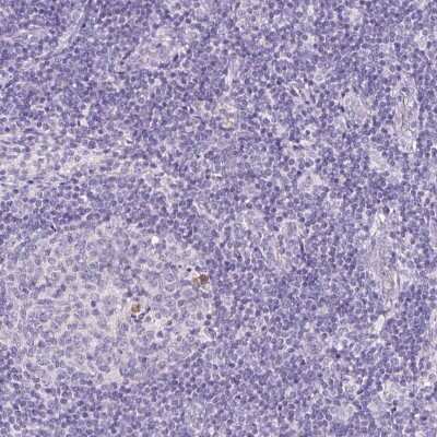 Immunohistochemistry-Paraffin: Peptidylglycine alpha-Amidating Monooxygenase/PAM Antibody [NBP2-34075]