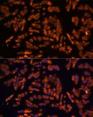 Immunocytochemistry/ Immunofluorescence: Periaxin Antibody - Azide and BSA Free [NBP2-93522]