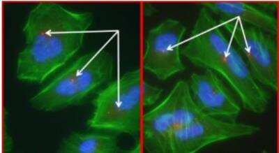 Immunocytochemistry/ Immunofluorescence: Pericentrin Antibody [NB100-61071]