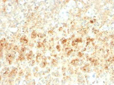 Immunohistochemistry-Paraffin: Perilipin-2/ADFP Antibody (ADFP/2755R) - Azide and BSA Free [NBP3-08454]