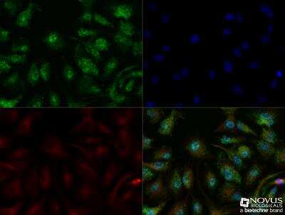 Immunocytochemistry/Immunofluorescence Staining of Perilipin-2/ADFP in HepG2 Cells