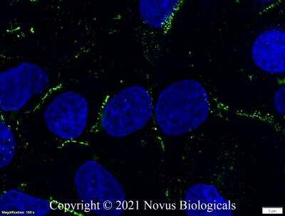 Immunocytochemistry/Immunofluorescence Analysis of Perilipin-2/ADFP in HepG2 Cells