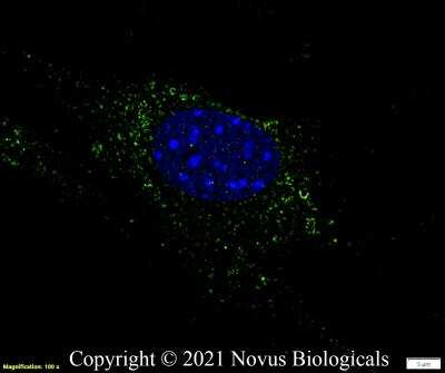 Immunocytochemistry/Immunofluorescence Staining of Perilipin-2/ADFP in NIH3T3 Cells