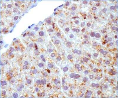 Immunohistochemical Staining of Perilipin-2/ADFP in Mouse Liver Tissue