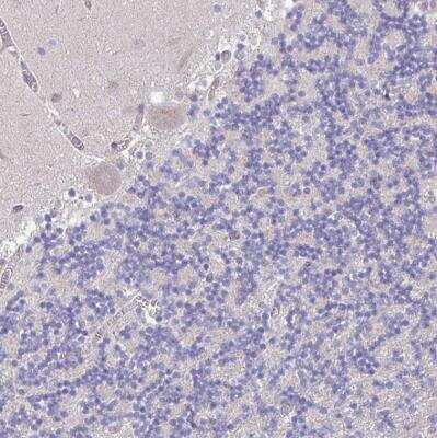 Immunohistochemistry-Paraffin: Perilipin-2/ADFP Antibody [NBP2-48532]