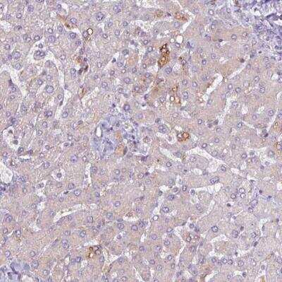 Immunohistochemistry-Paraffin: Perilipin-2/ADFP Antibody [NBP2-48532]