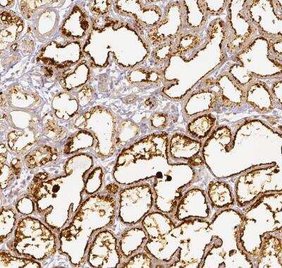 Immunohistochemistry-Paraffin: Perilipin-2/ADFP Antibody [NBP2-48532]