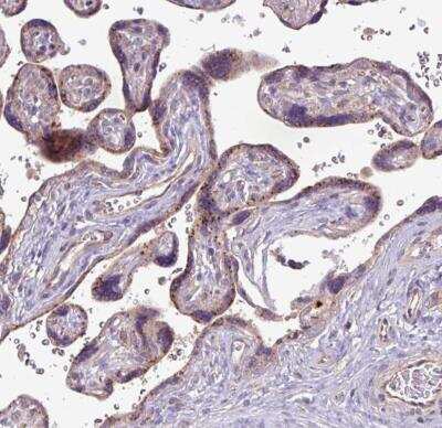Immunohistochemistry-Paraffin: Perilipin-2/ADFP Antibody [NBP2-48532]