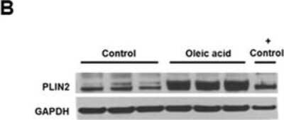 Western Blot Detection of Perilipin-2/ADFP in U138 GBM Cells