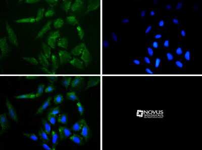 Immunocytochemistry/ Immunofluorescence: Perilipin-3/TIP47 Antibody [NB110-40764]