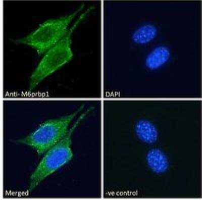 Immunocytochemistry/ Immunofluorescence: Perilipin-3/TIP47 Antibody [NBP1-06049]