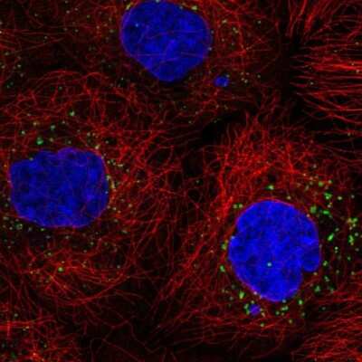 Immunocytochemistry/ Immunofluorescence: Perilipin-3/TIP47 Antibody [NBP2-49485]