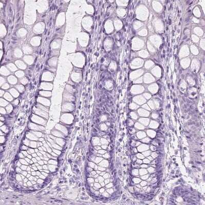 Immunohistochemistry-Paraffin: Perilipin-4 Antibody [NBP2-13776]