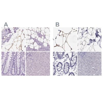 Immunohistochemistry-Paraffin: Perilipin-4 Antibody [NBP2-13776]