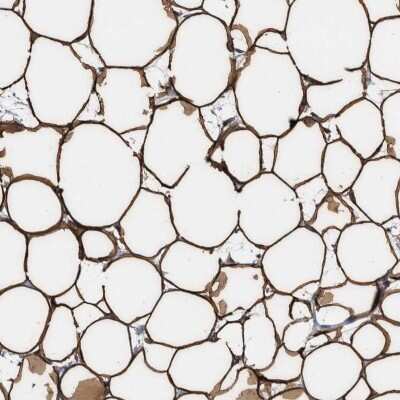 Immunohistochemistry-Paraffin: Perilipin Antibody [NBP1-87264]