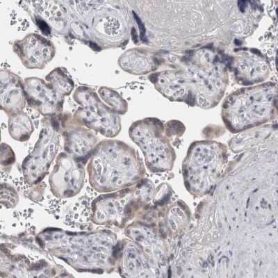 Immunohistochemistry-Paraffin: Perilipin Antibody [NBP1-87264]
