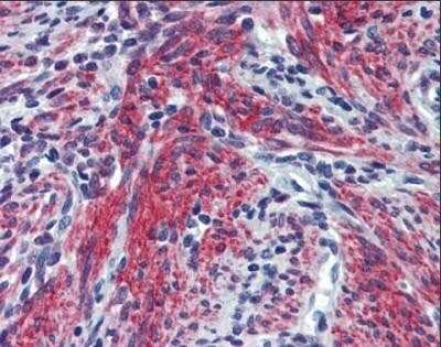 Immunohistochemistry-Paraffin: Periostin/OSF-2 Antibody [NBP1-59151]
