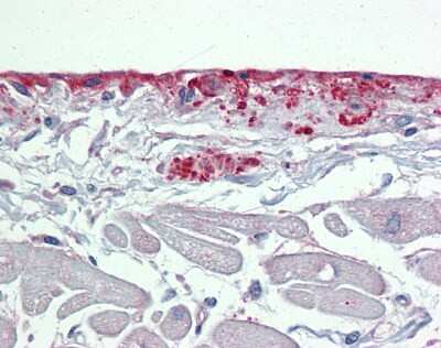 Immunohistochemistry-Paraffin: Periostin/OSF-2 Antibody [NBP1-59151]