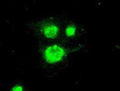 Immunocytochemistry/ Immunofluorescence: Periostin/OSF-2 Antibody (OTI1A1) [NBP1-47922]