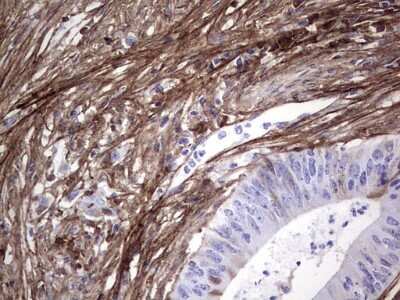Immunohistochemistry: Periostin/OSF-2 Antibody (OTI2B2) [NBP2-45371]
