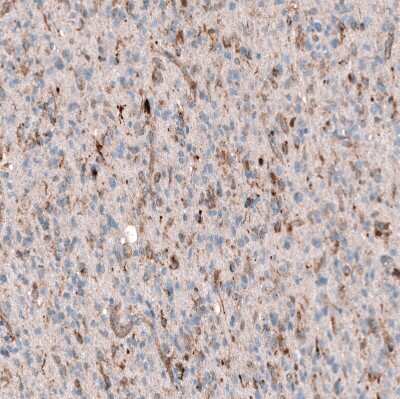 Immunohistochemistry-Paraffin: Periostin/OSF-2 Antibody (CL12087) [NBP3-15128]