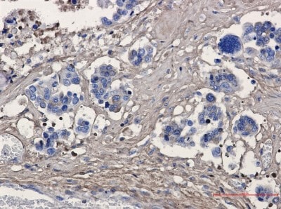 Immunohistochemistry-Paraffin: Periostin/OSF-2 Antibody (S03-7E3) [NBP3-20049]