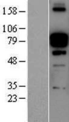 Western Blot: Periostin/OSF-2 Overexpression Lysate [NBP2-11089]