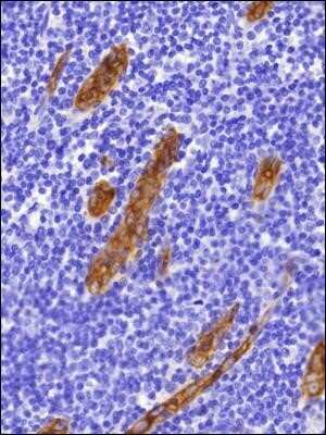 Immunohistochemistry: Peripheral Node Addressin Antibody (MECA-79) - Low Endotoxin and Azide Free [NBP2-78790]