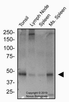 Western Blot: Peripheral Node Addressin Antibody (MECA-79)Non-Recombinant Monoclonal [NB100-77673]