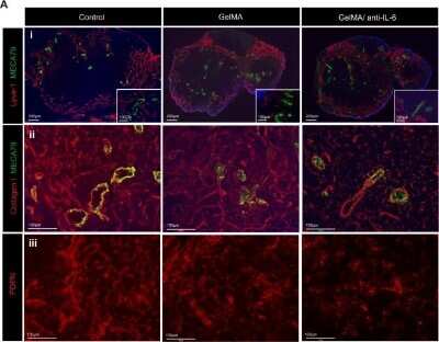Immunohistochemistry: Peripheral Node Addressin Antibody (MECA-79R) - BSA Free [NBP2-78792]