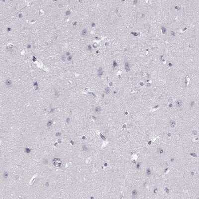 Immunohistochemistry-Paraffin: Peripherin 2/PRPH2 Antibody [NBP1-86687]