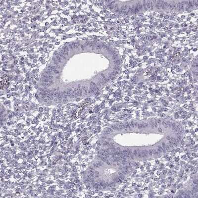 Immunohistochemistry-Paraffin: Peripherin 2/PRPH2 Antibody [NBP1-86687]