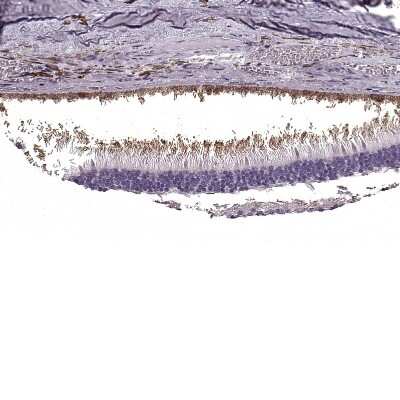 Immunohistochemistry-Paraffin: Peripherin 2/PRPH2 Antibody [NBP1-86687]