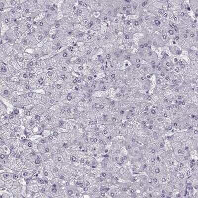 Immunohistochemistry-Paraffin: Peripherin 2/PRPH2 Antibody [NBP1-86687]