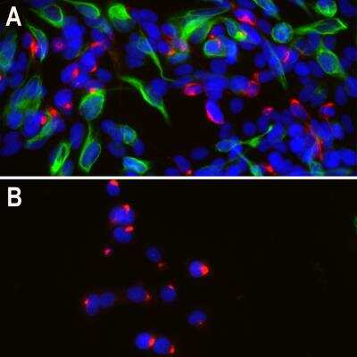 Immunocytochemistry/ Immunofluorescence: Peripherin Antibody (8G2) [NB300-138]